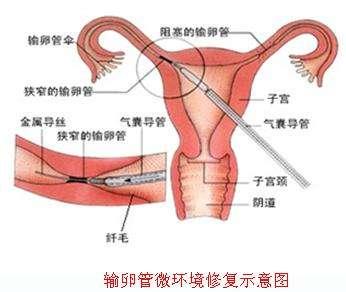通草的功效與作用能通輸卵管堵塞,高速響應(yīng)計劃實施_高級款41.765